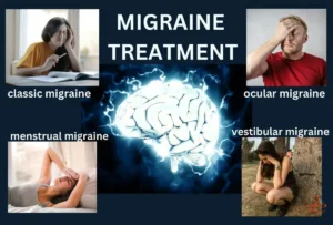 Homeopathy doctor for migraine treatment