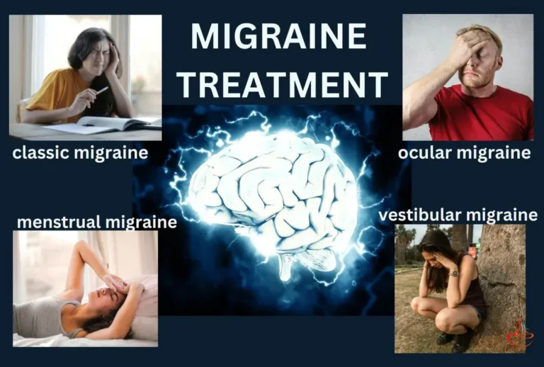 Homeopathy doctor for migraine treatment