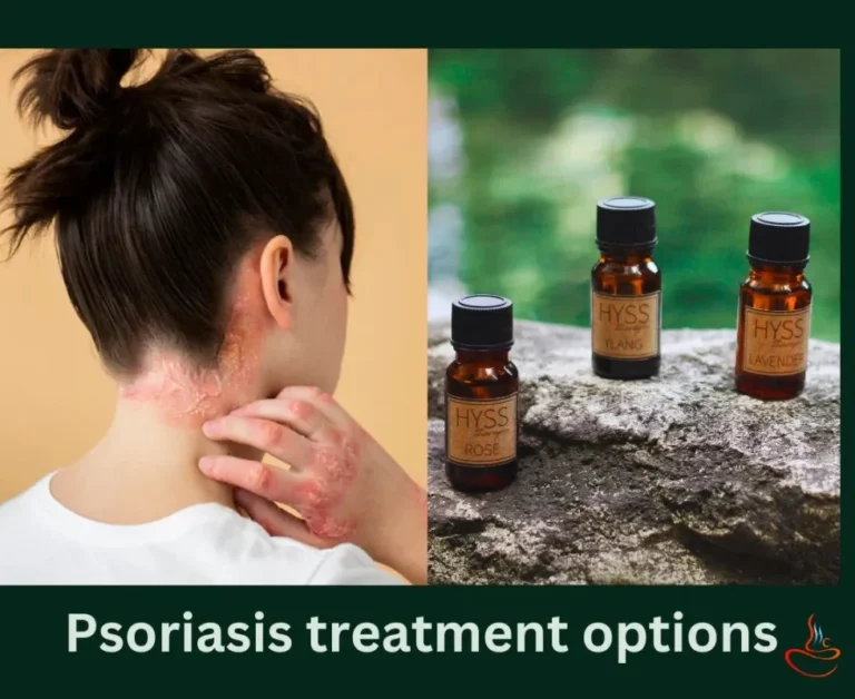 Psoriasis treatment options to treat itch and psoriatic scales